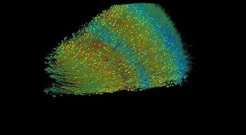 See The Human Brain Like Never Before