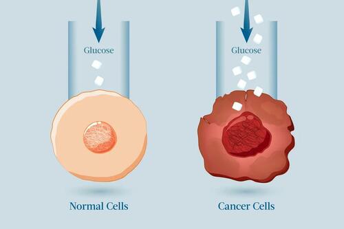 Does Sugar Feed Cancer?