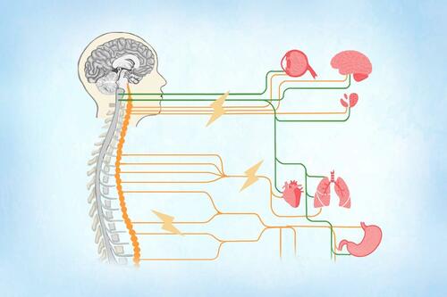 Dysautonomia: Symptoms, Causes, Treatments, And Natural Approaches