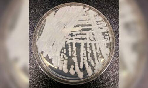 CDC Warns Of Dangerous Fungal Infection Spreading Through US At 'Alarming Rate' Image-3-700x420