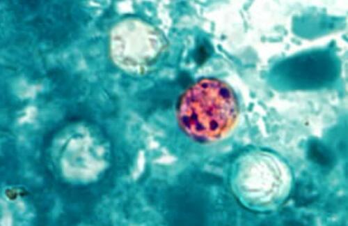 Poo-Demic: As Cases Spread To 41 States, FDA Suddenly Can't Find Parasite In Recalled Lettuce