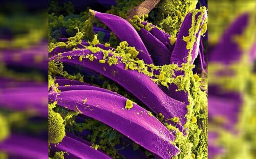 New Mexico Man Diagnosed With Plague In State’s First Case This Year, Say Officials